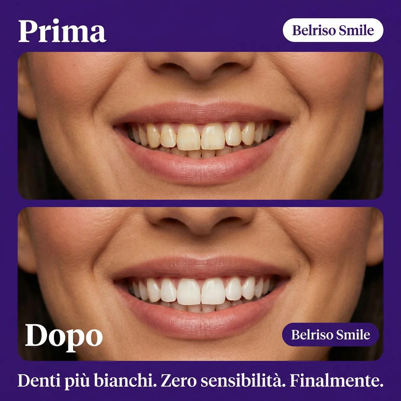Strisce Sbiancanti